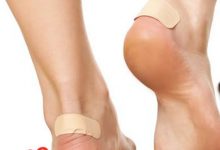 درمان و جلوگیری از ایجاد زخم پشت پا در اثر پوشیدن کفش و پیاده روی طولانی