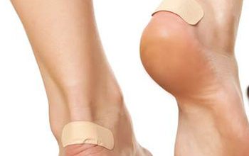 درمان و جلوگیری از ایجاد زخم پشت پا در اثر پوشیدن کفش و پیاده روی طولانی